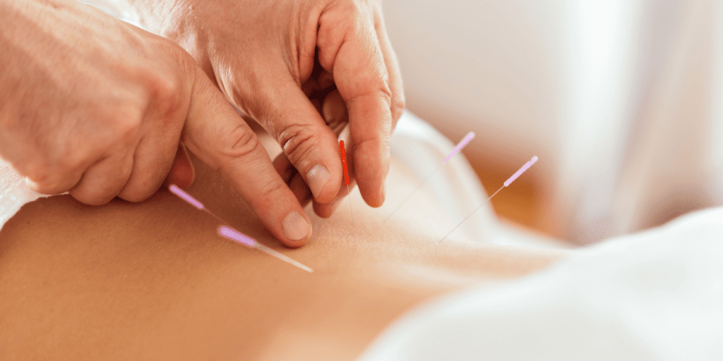 Agopuntura Centro MeC Alghero