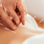 Agopuntura Centro MeC Alghero