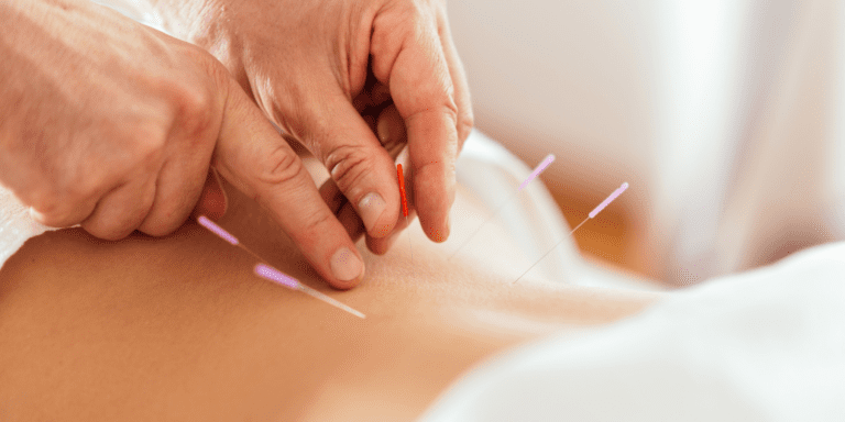 Agopuntura Centro MeC Alghero