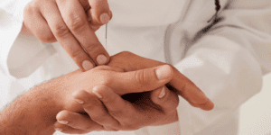 Agopuntura Centro MeC Alghero